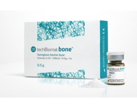 Chirurgie & Comblements osseux